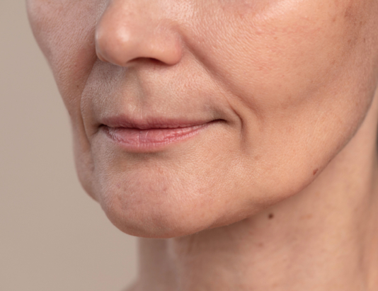 Skin Tightening Sydney