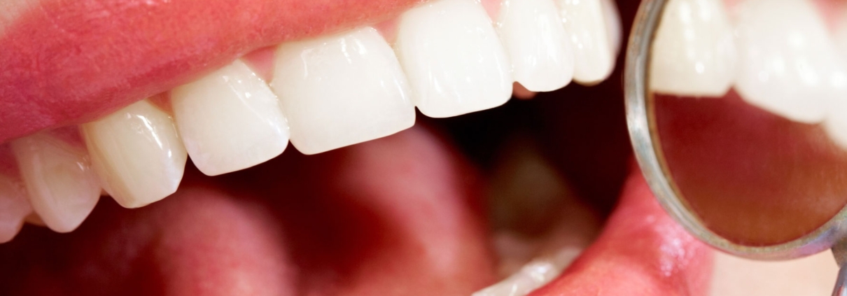 cosmetic dentistry houston texas