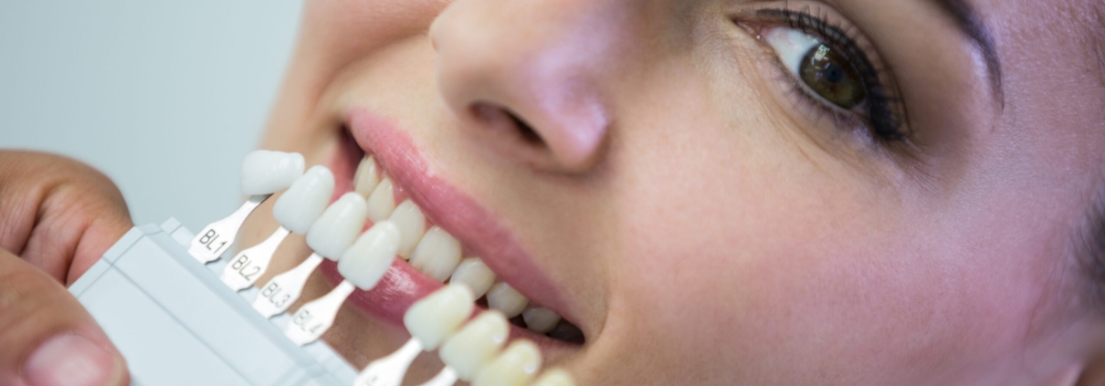Tooth Replacement Houston