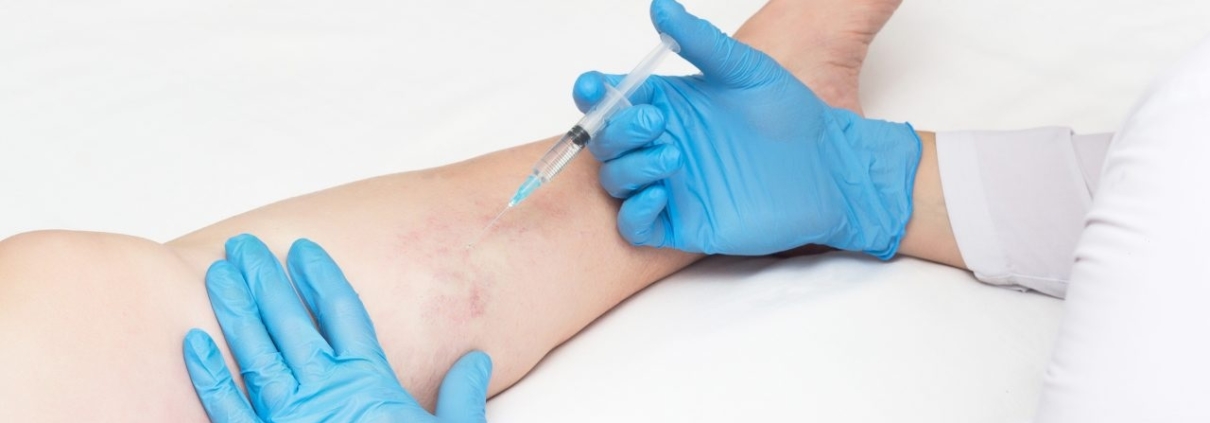 Long Island Vein Experts