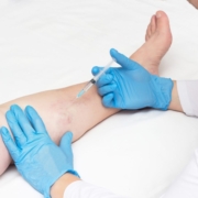 Long Island Vein Experts