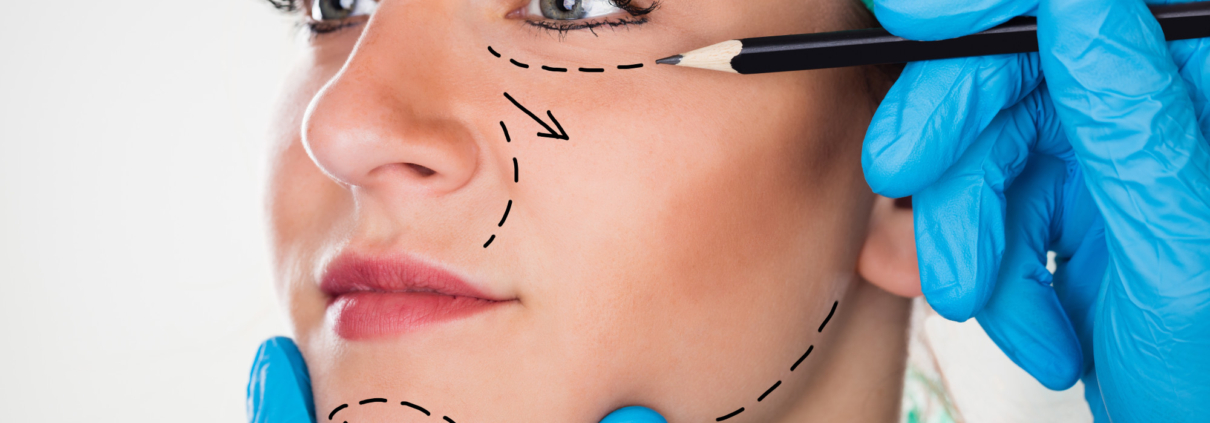 Eye Bag Removal