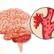 How Do I Choose the Best Neurologist in Jaipur?