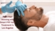 prp hair treatment los angeles