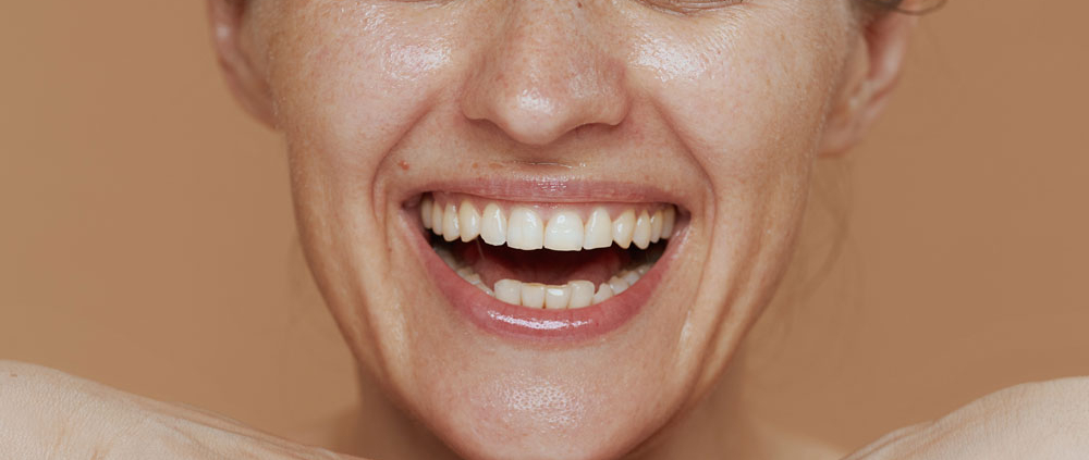 smile makeover houston