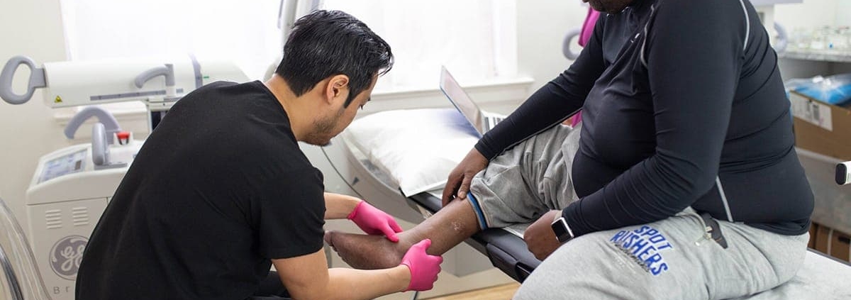 How Much Does Varicose Vein Treatment Cost