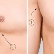 How-to-Tell-If-You-Have-Gynecomastia