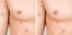 How-to-Tell-If-You-Have-Gynecomastia