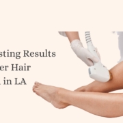 laser hair removal los angeles