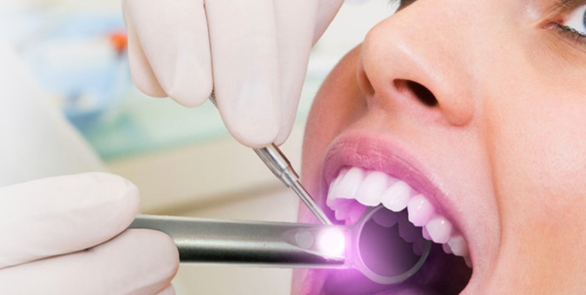 Oral Cancer Screening
