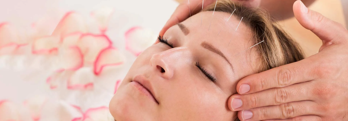 acupuncture service