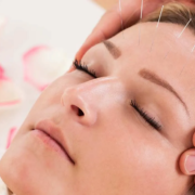 acupuncture service