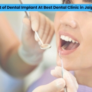 dental implant cost at best dental clinic in jaipur