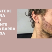 transplante de barba