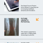 Trauma Fixation Device Market