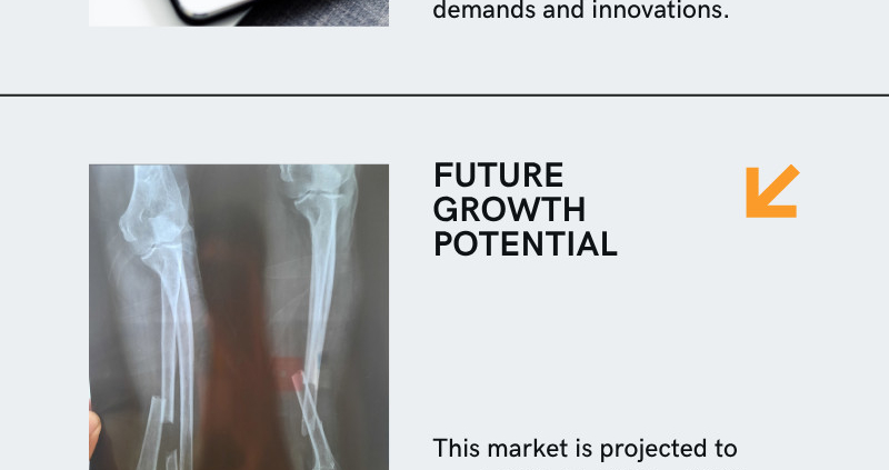 Trauma Fixation Device Market