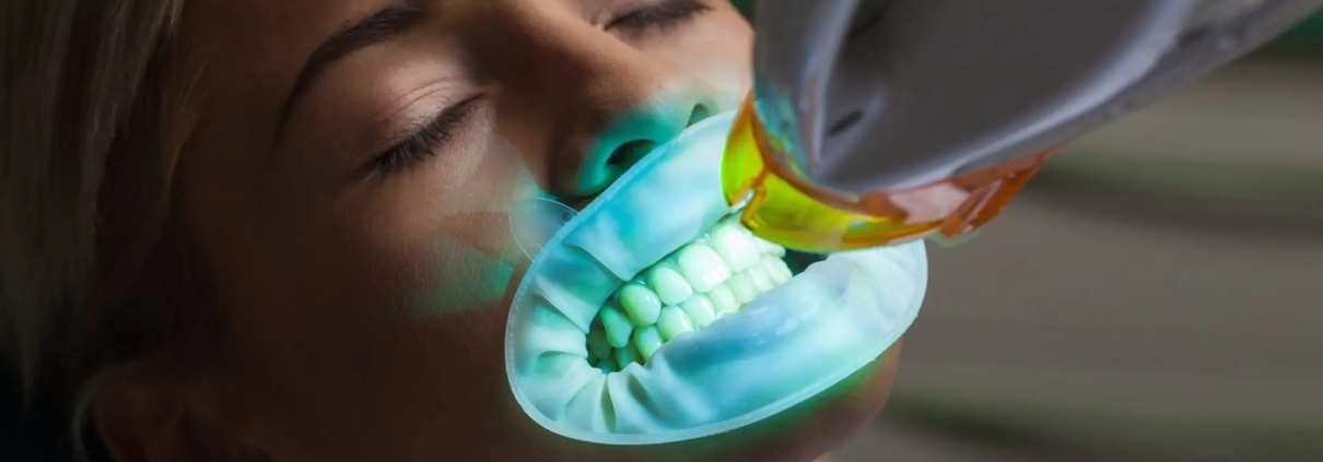 all on 4 dental implants la mirada