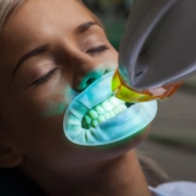 all on 4 dental implants la mirada