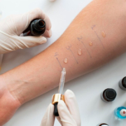 Patient consulting an allergist doctor in Dubai for chronic allergy management