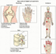 Degenerative joint disease icd 10