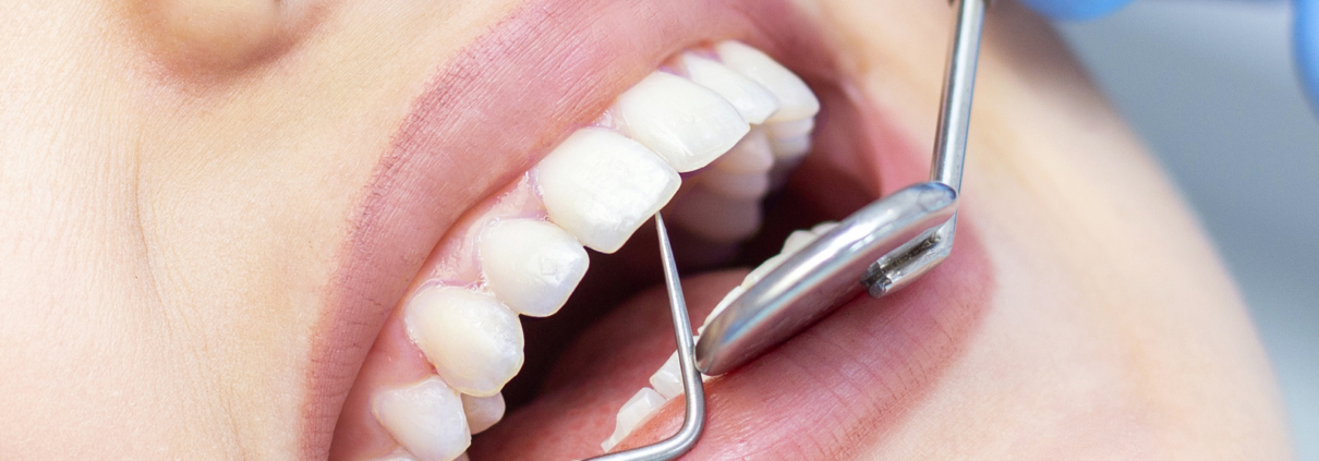 dentist office fontana
