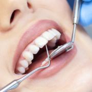 dentist office fontana
