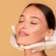 derma filler treatments image
