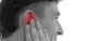 double-ear-infection