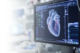 echo heart test price in Lahore