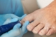 ingrown toenail surgery perth
