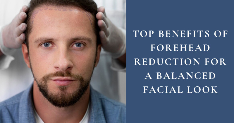 forehead reduction Los Angeles