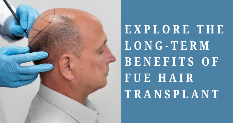 fue hair transplant Los Angeles