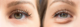 bags under eye surgery.