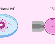 ivf
