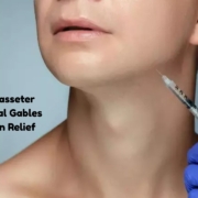 masseter botox coral gables