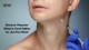 masseter botox coral gables