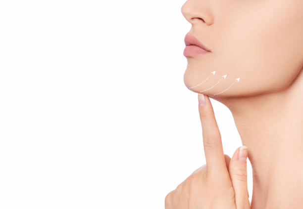 Double chin removal in Jeddah