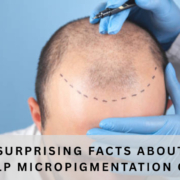 scalp micropigmentation cost