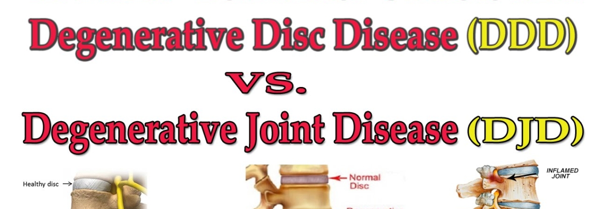 things to avoid with degenerative disc disease
