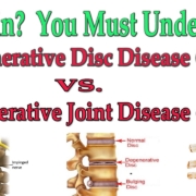 things to avoid with degenerative disc disease