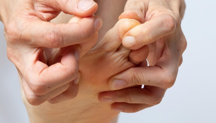 wart surgery